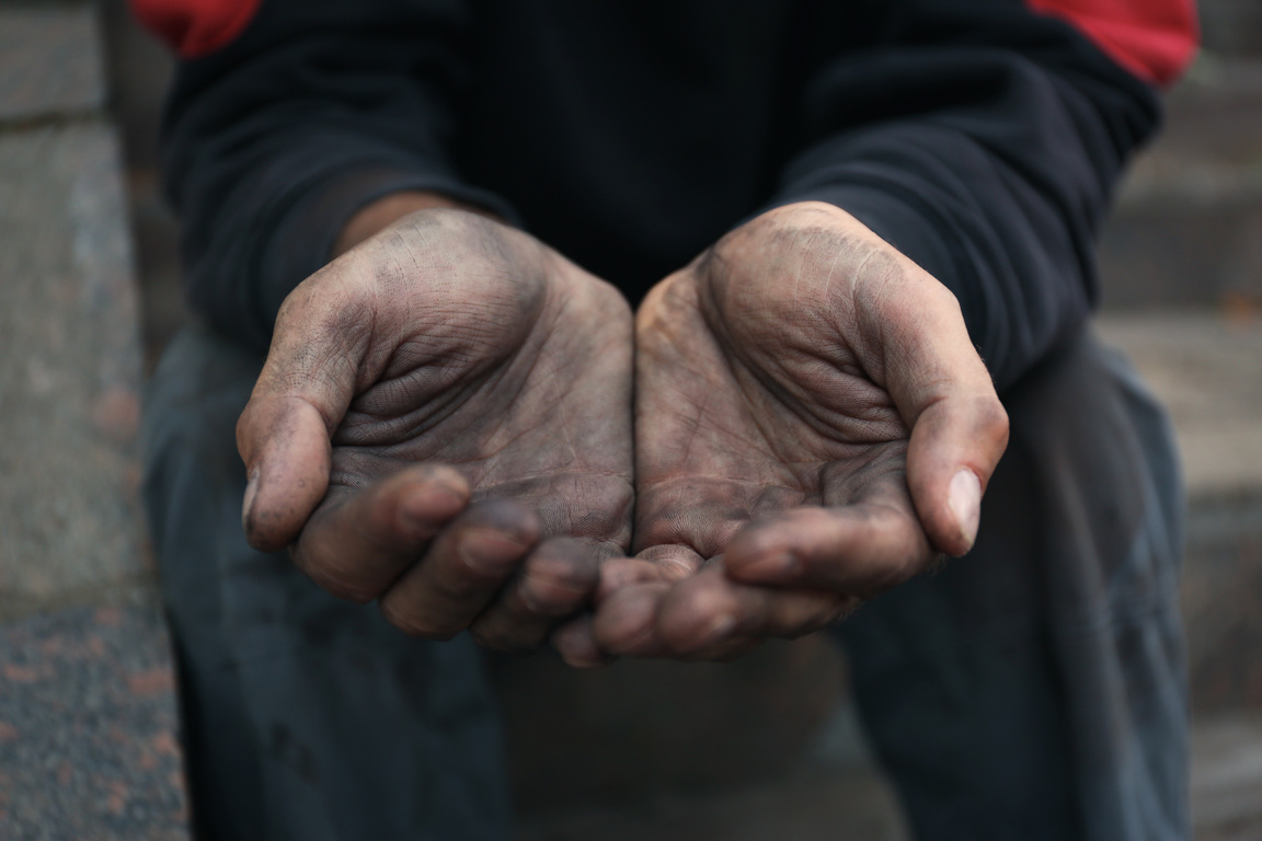 Poor Homeless Man Begging for Help Outdoors, Closeup